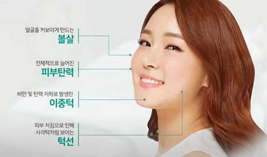 라엘라의원의 효과적인 리프팅 시술