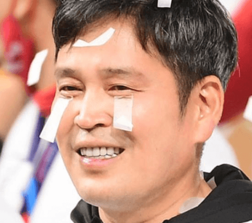 관상학으로 본 정용진 부회장의 귓볼 변화와 그 의미
